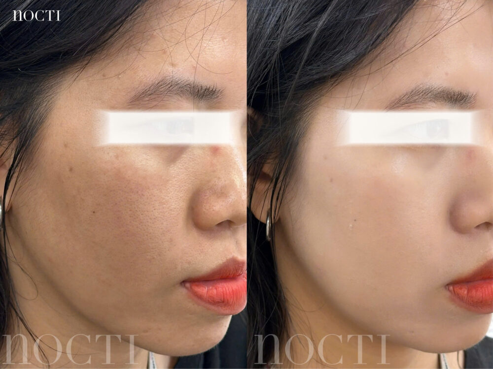 Kem Nâng Tone Nocti - Hình ảnh 5