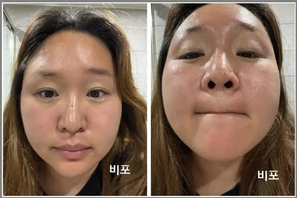 Before after khách hàng 1