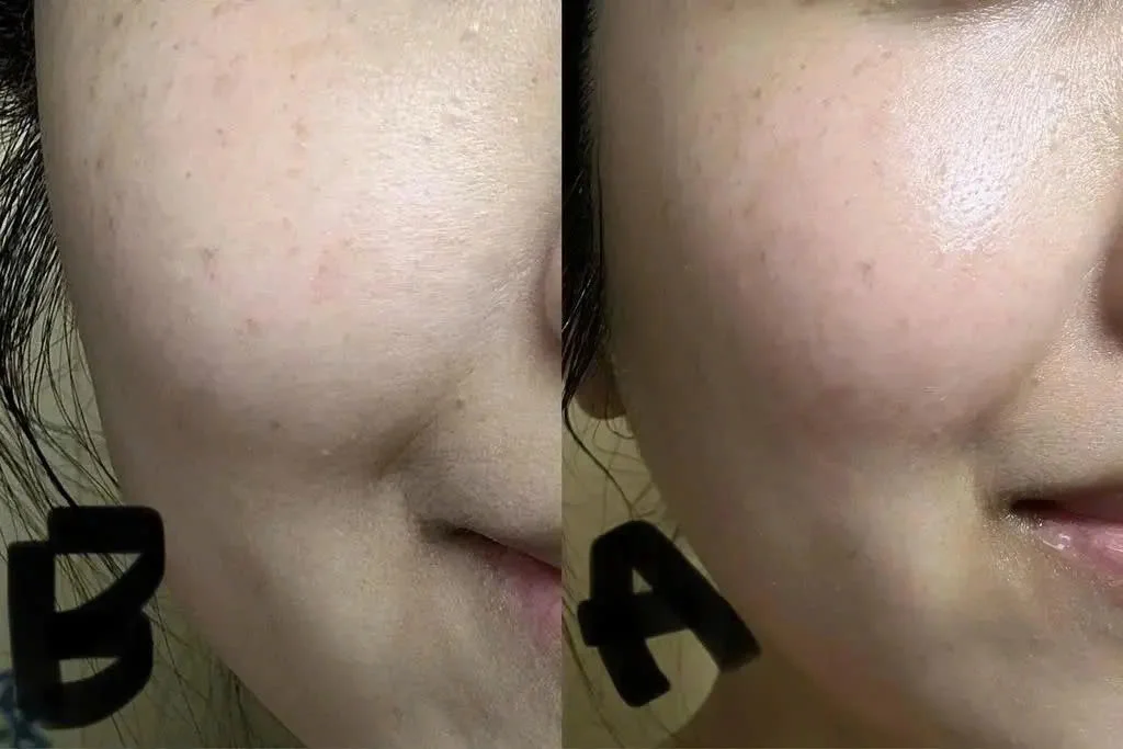 Before after khách hàng 2